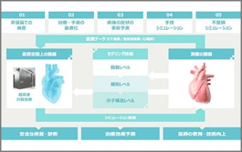 ped UT-Heart（国立循環器病研究センター）