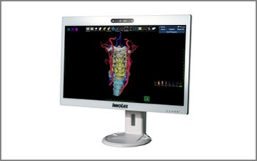 Volume N3D Medical Image Visualization System