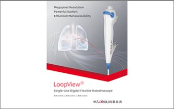 LoopView ® 使い捨てデジタルフレキシブル気管支鏡